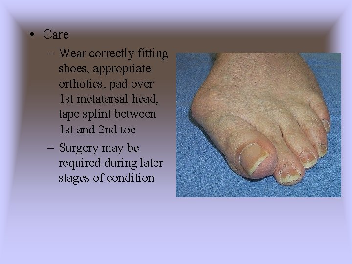  • Care – Wear correctly fitting shoes, appropriate orthotics, pad over 1 st