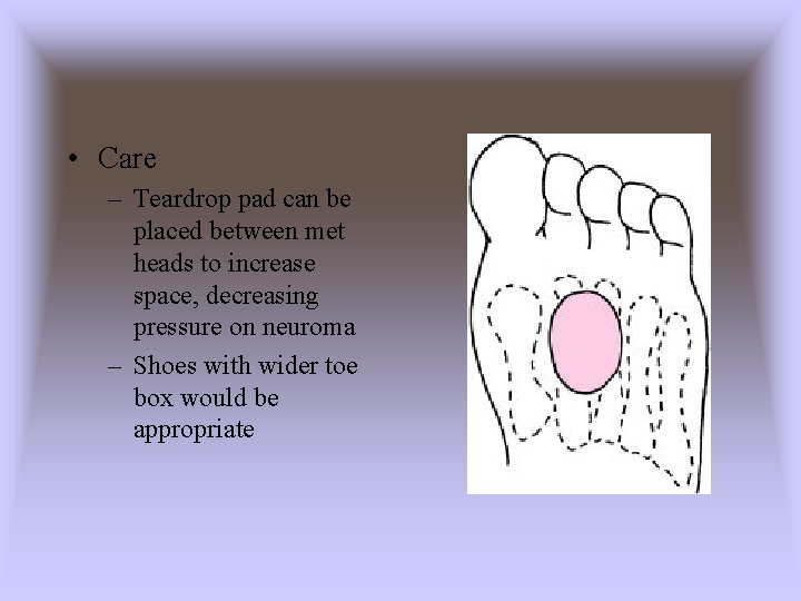  • Care – Teardrop pad can be placed between met heads to increase