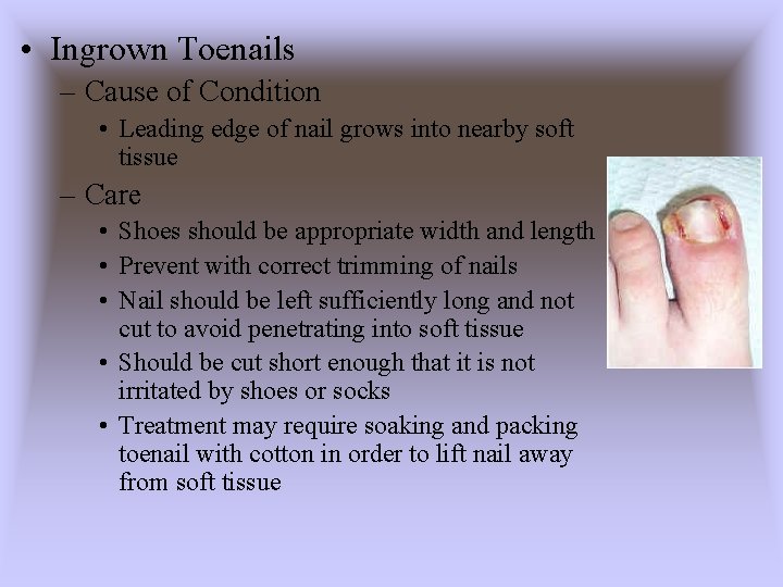  • Ingrown Toenails – Cause of Condition • Leading edge of nail grows