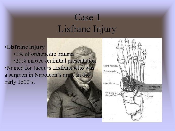 Case 1 Lisfranc Injury • Lisfranc injury • 1% of orthopedic trauma • 20%