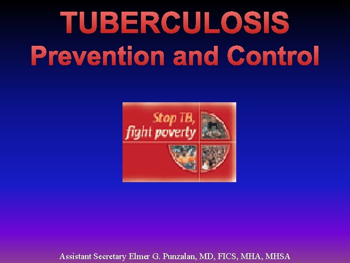 TUBERCULOSIS Prevention and Control Assistant Secretary Elmer G. Punzalan, MD, FICS, MHA, MHSA 