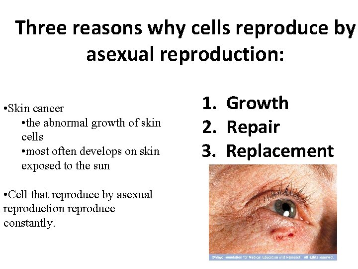 Three reasons why cells reproduce by asexual reproduction: • Skin cancer • the abnormal