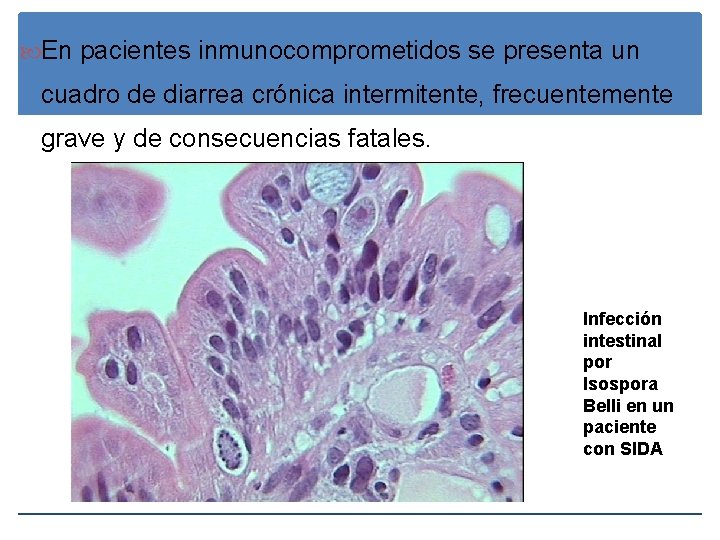  En pacientes inmunocomprometidos se presenta un cuadro de diarrea crónica intermitente, frecuentemente grave