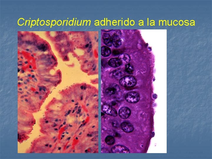 Criptosporidium adherido a la mucosa 