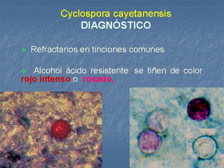 Cyclospora cayetanensis DIAGNÓSTICO v Refractarios en tinciones comunes. Alcohol ácido resistente: se tiñen de