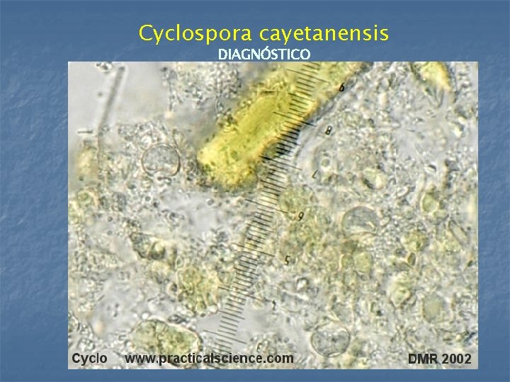 Cyclospora cayetanensis DIAGNÓSTICO 