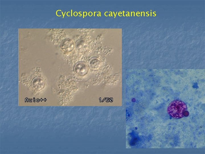 Cyclospora cayetanensis 