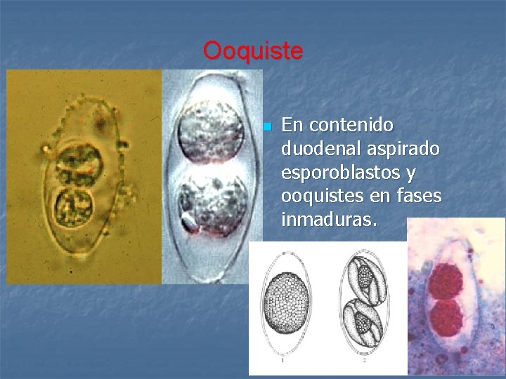 Ooquiste n En contenido duodenal aspirado esporoblastos y ooquistes en fases inmaduras. 