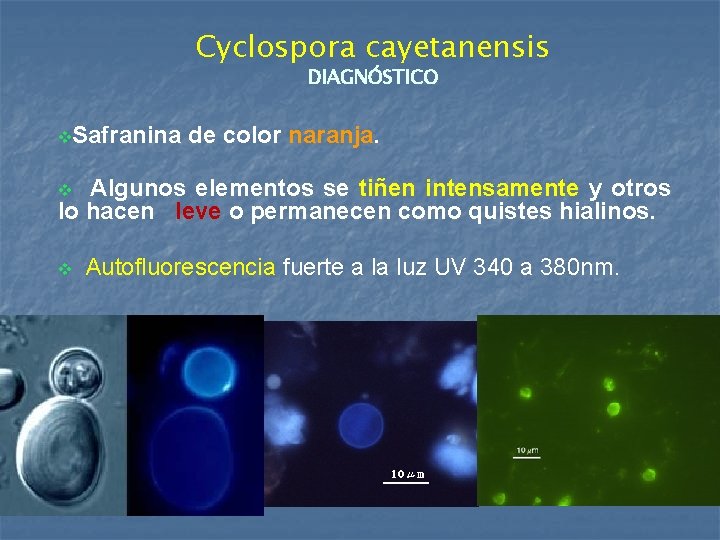 Cyclospora cayetanensis DIAGNÓSTICO v. Safranina de color naranja. Algunos elementos se tiñen intensamente y