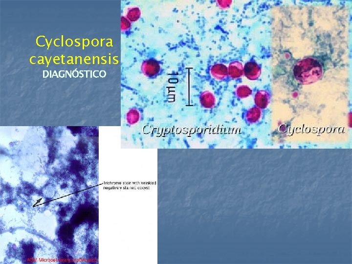 Cyclospora cayetanensis DIAGNÓSTICO 