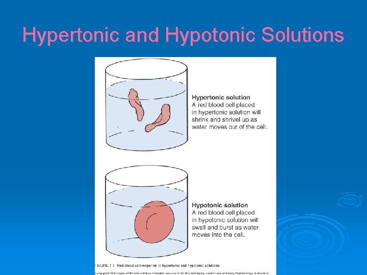 Hypertonic and Hypotonic Solutions 