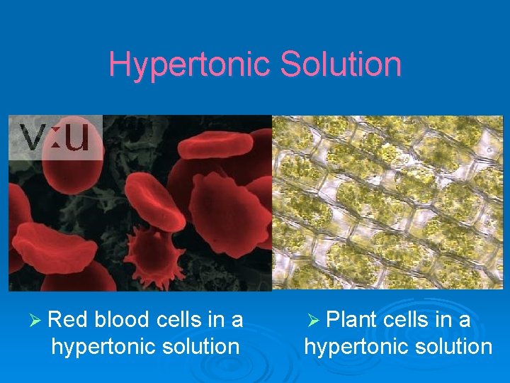 Hypertonic Solution Ø Red blood cells in a hypertonic solution Ø Plant cells in