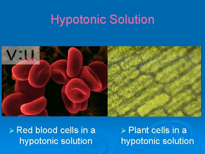 Hypotonic Solution Ø Red blood cells in a hypotonic solution Ø Plant cells in
