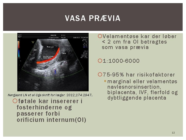 VASA PRÆVIA Velamentøse kar der løber < 2 cm fra OI betragtes som vasa