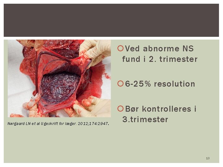  Ved abnorme NS fund i 2. trimester 6 -25% resolution Nørgaard LN et