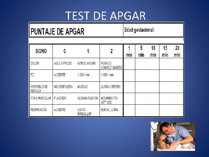 TEST DE APGAR 