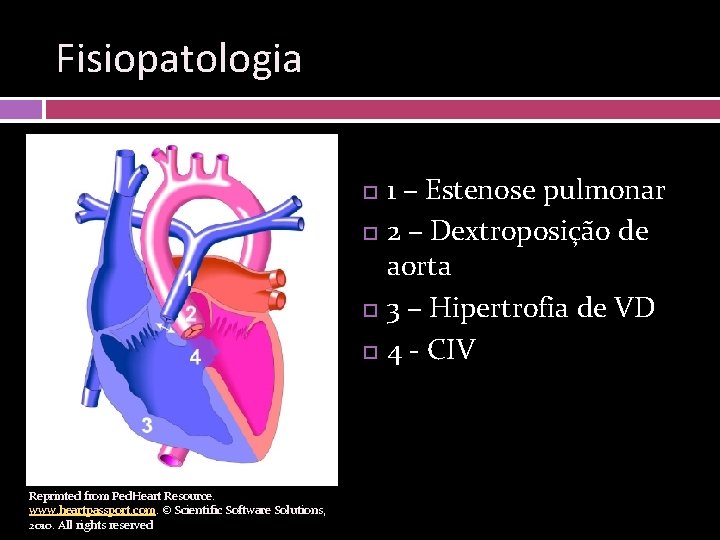 Fisiopatologia Reprinted from Ped. Heart Resource. www. heartpassport. com. © Scientific Software Solutions, 2010.