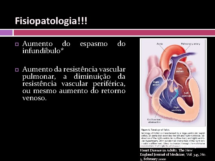 Fisiopatologia!!! Aumento do infundíbulo* espasmo do Aumento da resistência vascular pulmonar, a diminuição da