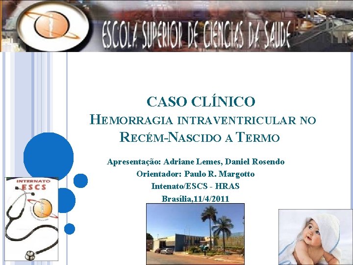 CASO CLÍNICO HEMORRAGIA INTRAVENTRICULAR NO RECÉM-NASCIDO A TERMO Apresentação: Adriane Lemes, Daniel Rosendo Orientador: CASO CLÍNICO HEMORRAGIA INTRAVENTRICULAR NO RECÉM-NASCIDO A TERMO Apresentação: Adriane Lemes, Daniel Rosendo Orientador: