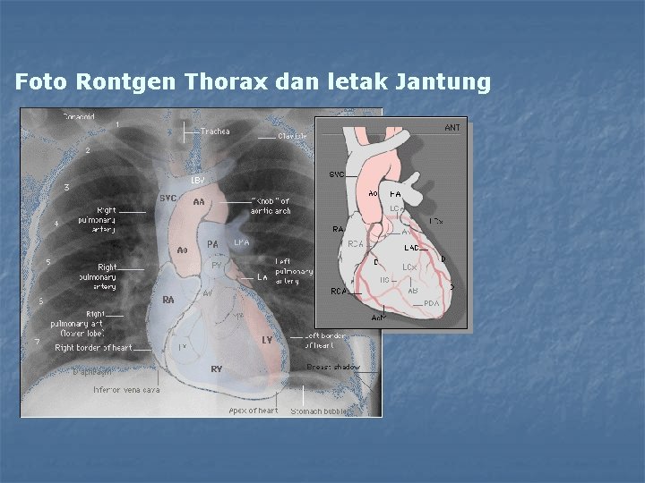 Foto Rontgen Thorax dan letak Jantung 