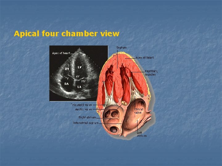 Apical four chamber view 