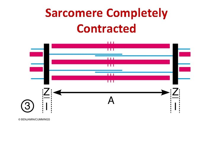 Sarcomere Completely Contracted 