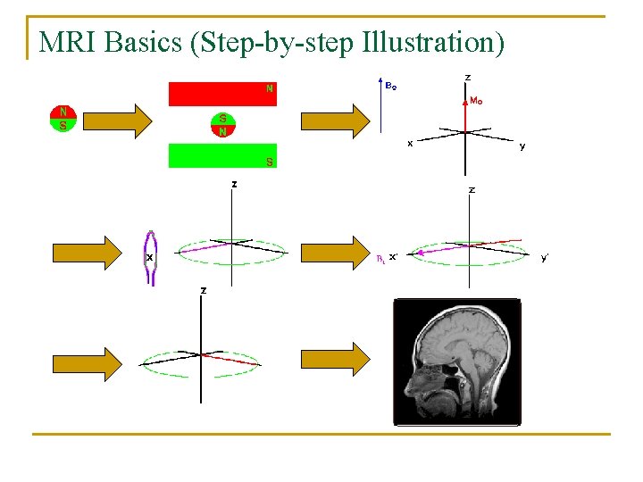 MRI Basics (Step-by-step Illustration) 