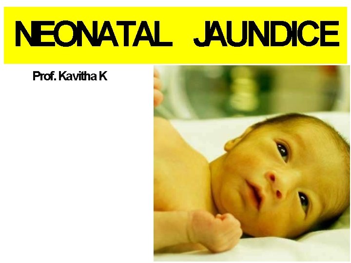 NEONATAL JAUNDICE Prof. Kavitha K 