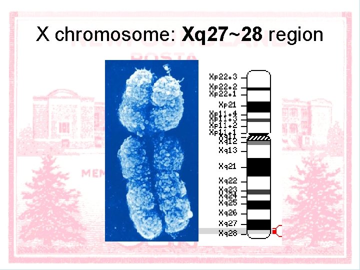 X chromosome: Xq 27~28 region 