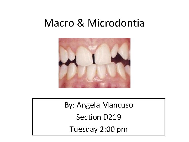 Macro & Microdontia By: Angela Mancuso Section D 219 Tuesday 2: 00 pm 