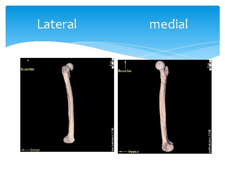 Lateral medial 