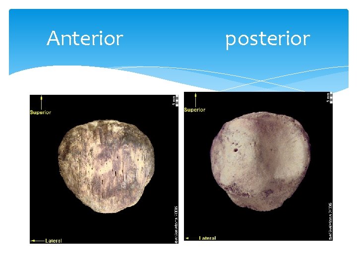 Anterior posterior 