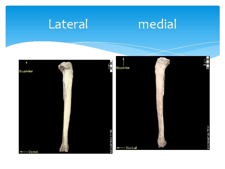 Lateral medial 