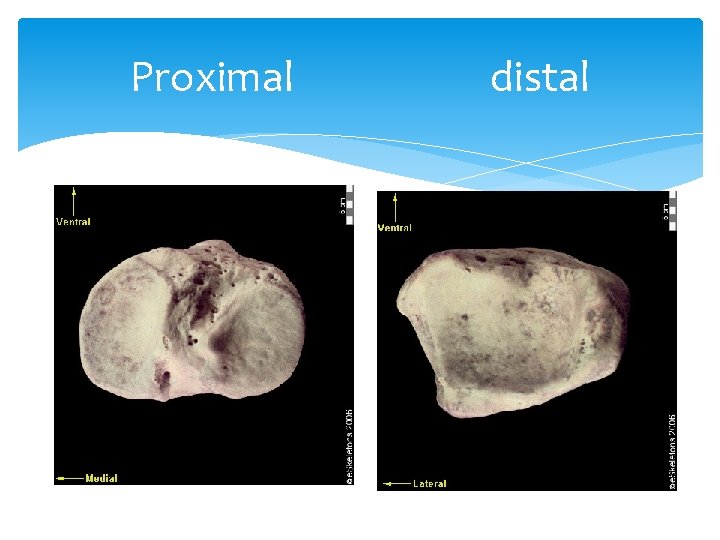 Proximal distal 