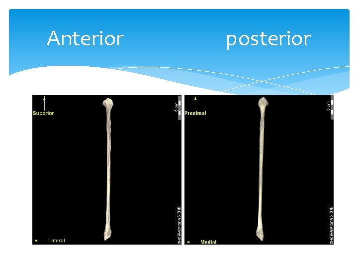 Anterior posterior 