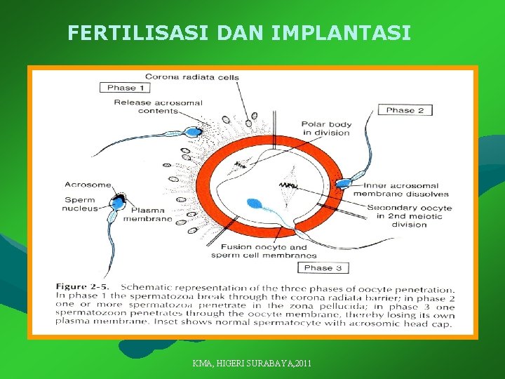 FERTILISASI DAN IMPLANTASI KMA, HIGERI SURABAYA, 2011 