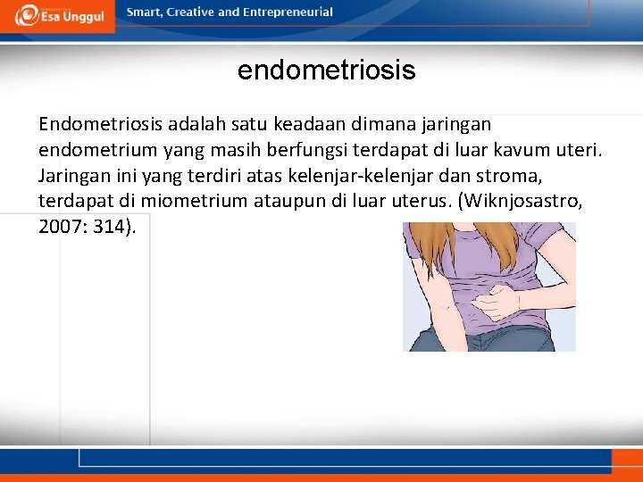 endometriosis Endometriosis adalah satu keadaan dimana jaringan endometrium yang masih berfungsi terdapat di luar