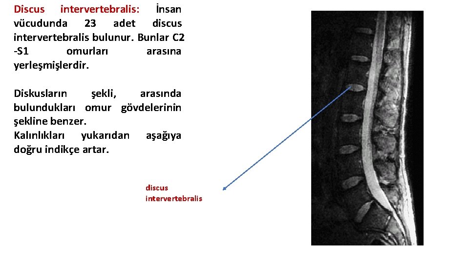Discus intervertebralis: İnsan vücudunda 23 adet discus intervertebralis bulunur. Bunlar C 2 -S 1 Discus intervertebralis: İnsan vücudunda 23 adet discus intervertebralis bulunur. Bunlar C 2 -S 1
