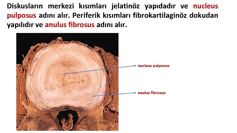 Diskusların merkezi kısımları jelatinöz yapıdadır ve nucleus pulposus adını alır. Periferik kısımları fibrokartilaginöz dokudan Diskusların merkezi kısımları jelatinöz yapıdadır ve nucleus pulposus adını alır. Periferik kısımları fibrokartilaginöz dokudan