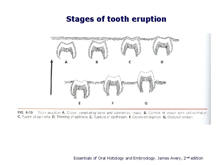Stages of tooth eruption Essentials of Oral Histology and Embryology. James Avery, 2 nd