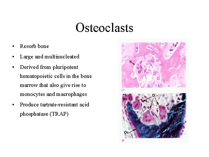 Osteoclasts • Resorb bone • Large and multinucleated • Derived from pluripotent hematopoietic cells