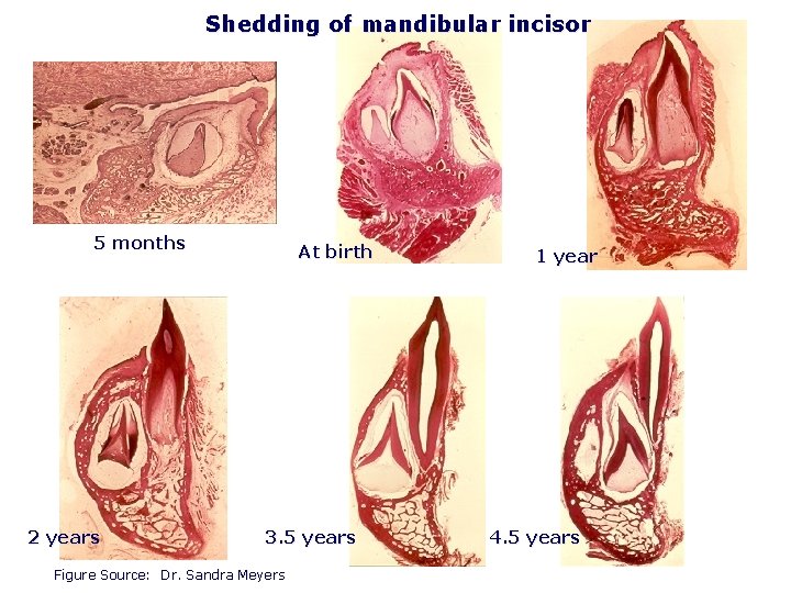 Shedding of mandibular incisor 5 months 2 years At birth 3. 5 years Figure
