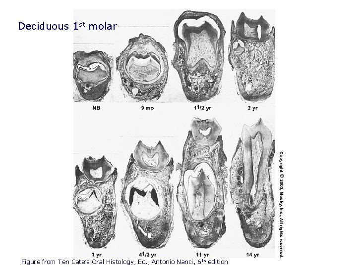 Deciduous 1 st molar Figure from Ten Cate’s Oral Histology, Ed. , Antonio Nanci,