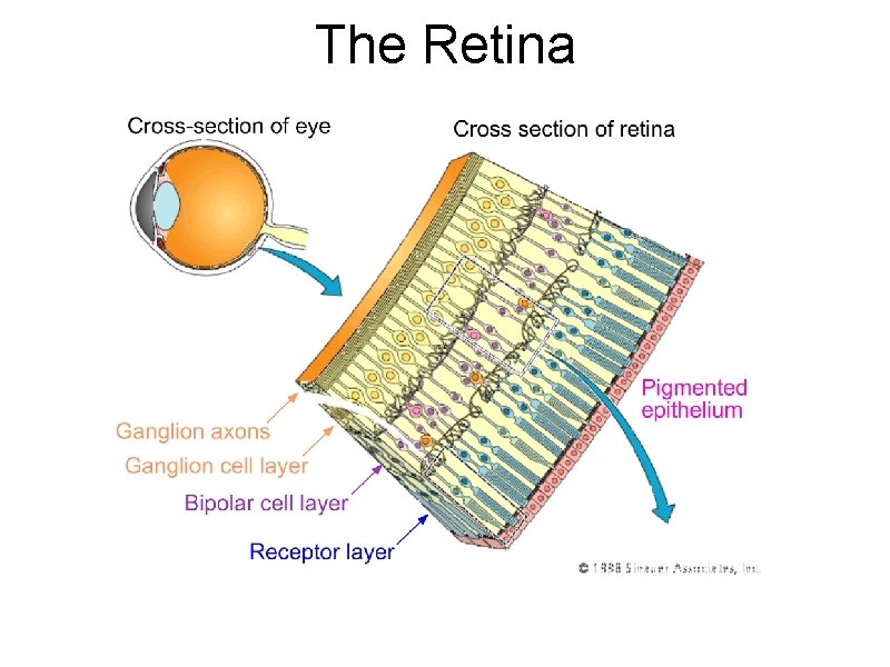 The Retina 