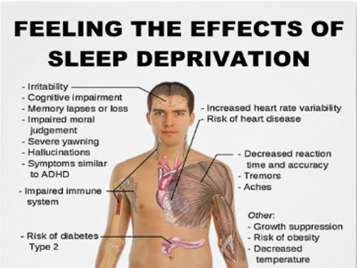 Sleep Deficiency Sleep Deficiency