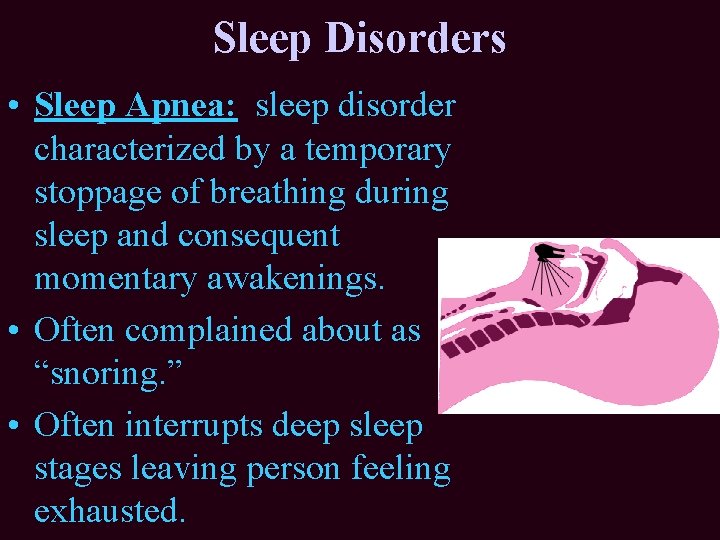 Sleep Disorders • Sleep Apnea: sleep disorder characterized by a temporary stoppage of breathing Sleep Disorders • Sleep Apnea: sleep disorder characterized by a temporary stoppage of breathing