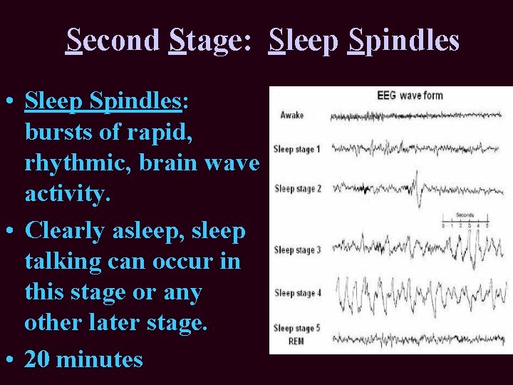Second Stage: Sleep Spindles • Sleep Spindles: bursts of rapid, rhythmic, brain wave activity. Second Stage: Sleep Spindles • Sleep Spindles: bursts of rapid, rhythmic, brain wave activity.