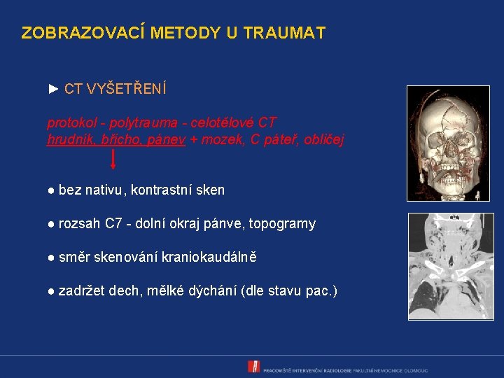 ZOBRAZOVACÍ METODY U TRAUMAT ► CT VYŠETŘENÍ protokol - polytrauma - celotělové CT hrudník,