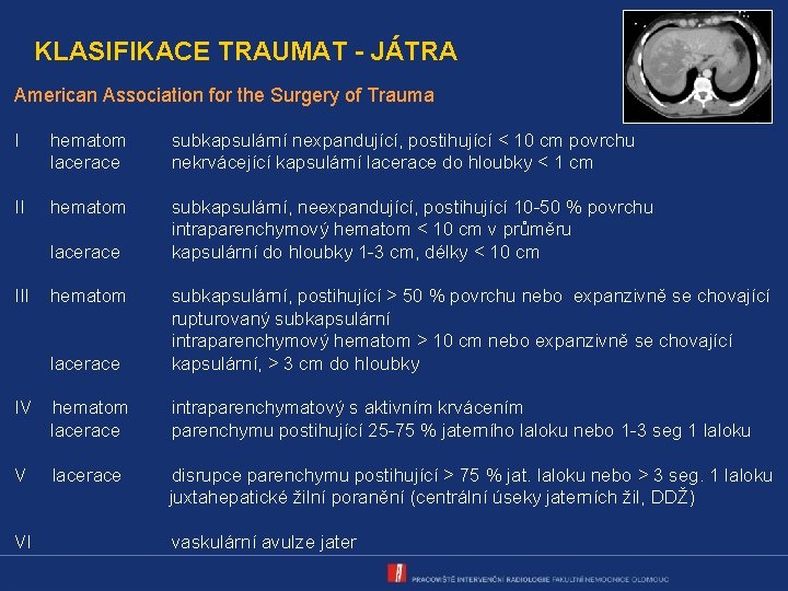 KLASIFIKACE TRAUMAT - JÁTRA American Association for the Surgery of Trauma I hematom lacerace