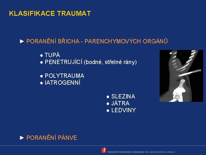 KLASIFIKACE TRAUMAT ► PORANĚNÍ BŘICHA - PARENCHYMOVÝCH ORGÁNŮ ● TUPÁ ● PENETRUJÍCÍ (bodné, střelné